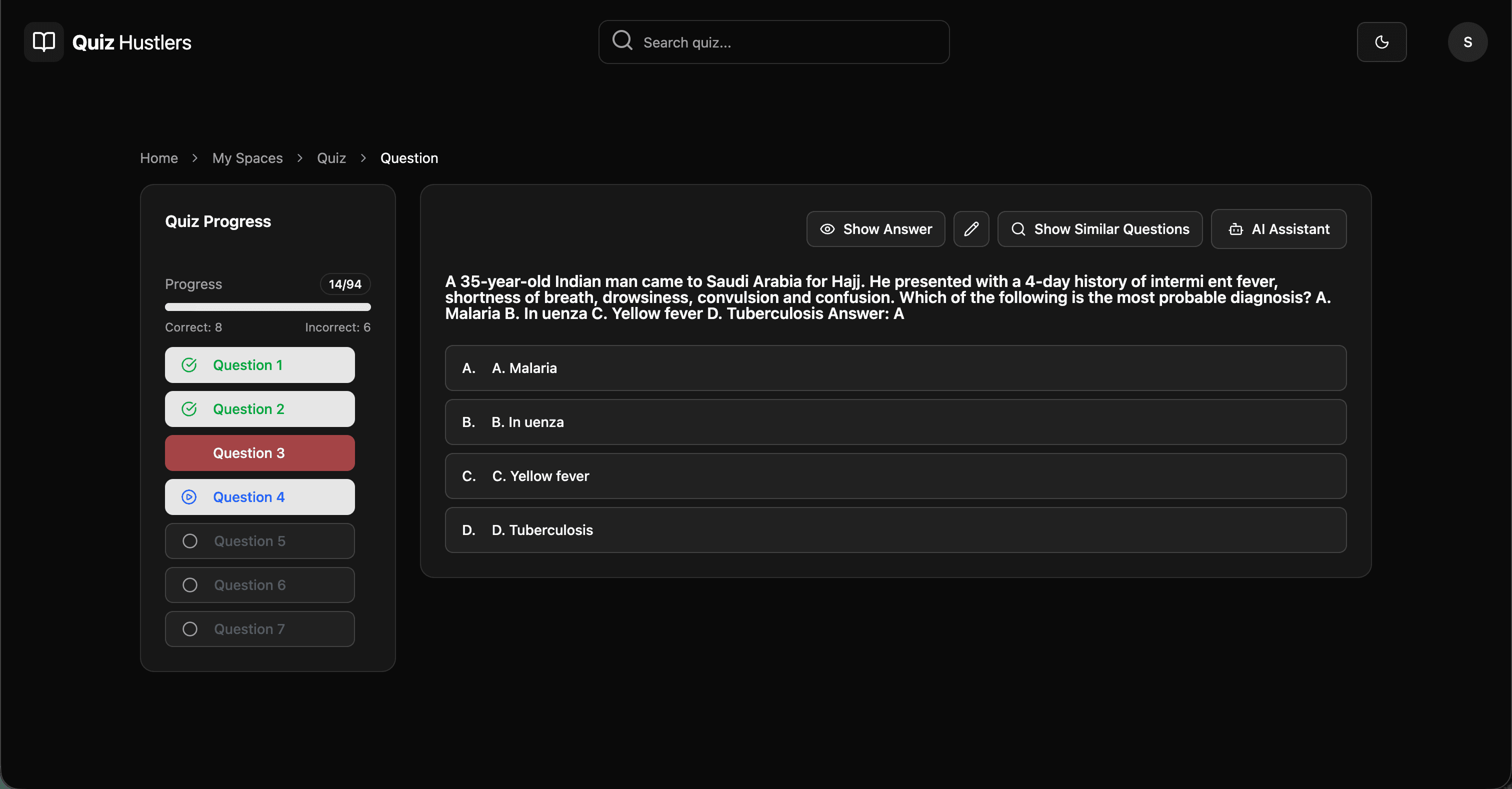 Question Card View