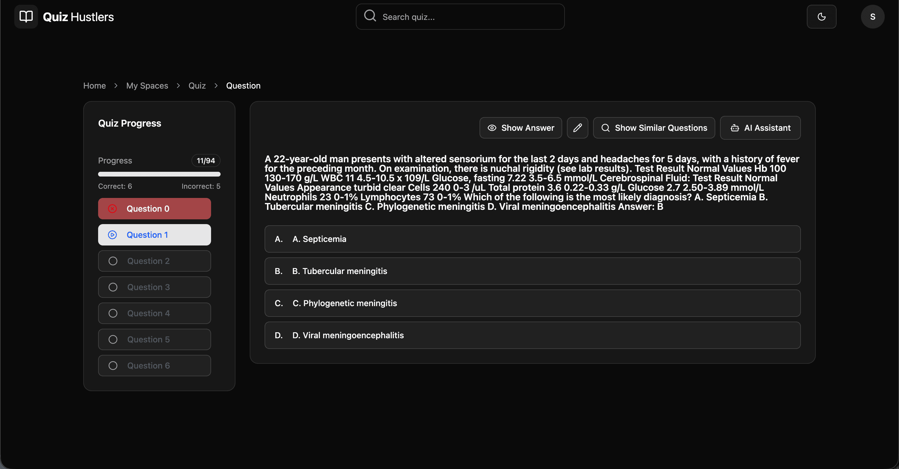Question Experience